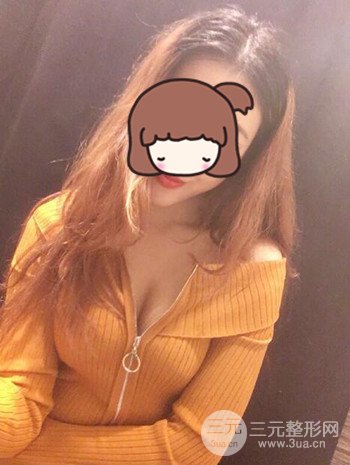 假體隆胸術(shù)后成功擺脫小學(xué)生身材，立現(xiàn)性感身材