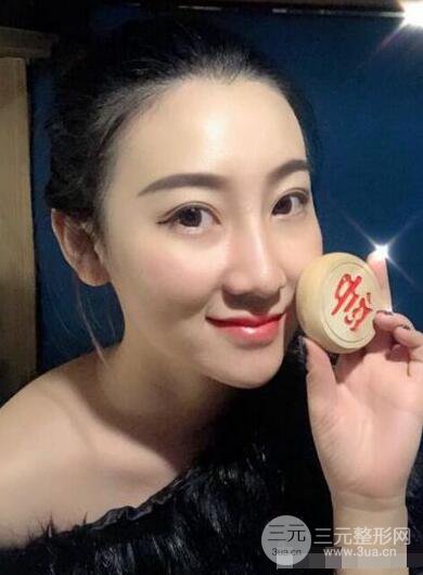 北京伊美爾徐軍隆鼻整形前后對(duì)比照片心情記錄小札