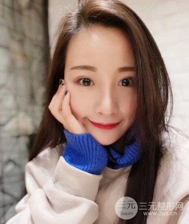 內(nèi)切微創(chuàng)去眼袋手術(shù)案例分享，附上手術(shù)恢復(fù)照片