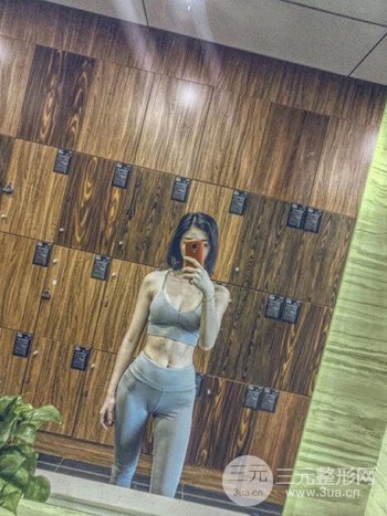 健身教練做了假體隆胸擁有凹凸有致的身材