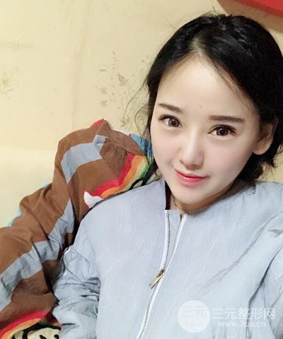 做了隆鼻整形成功落實精致小巧鼻 附上果圖