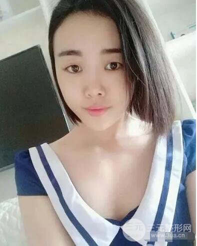 成都玉之光自體脂肪面部填充劉中國(guó)真人案例反饋|內(nèi)附對(duì)比前后照