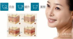 蛋白線(xiàn)面b提升多少錢(qián)?