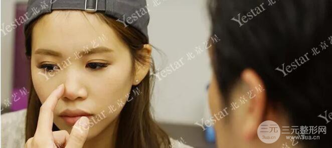 北京藝星仇侃敏耳軟骨隆鼻恢復(fù)過(guò)程|內(nèi)附前后對(duì)比圖