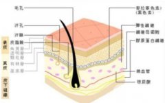 埋蛋白線(xiàn)有什么副作用?