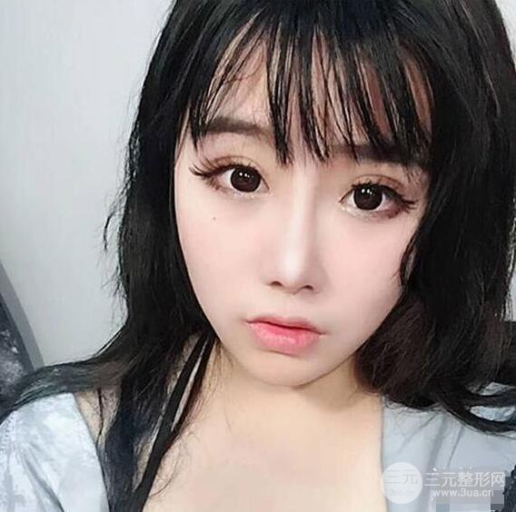 合肥壹加壹甘泉涌軟骨隆鼻前后對(duì)比圖|內(nèi)附真人案例恢復(fù)前過(guò)程