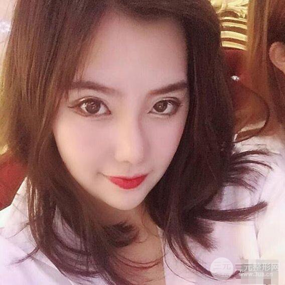 合肥壹加壹甘泉涌軟骨隆鼻前后對(duì)比圖|內(nèi)附真人案例恢復(fù)前過(guò)程