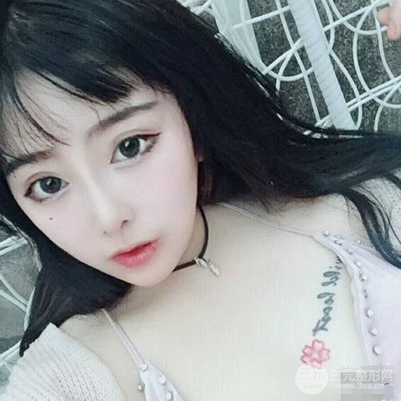 合肥壹加壹甘泉涌軟骨隆鼻前后對(duì)比圖|內(nèi)附真人案例恢復(fù)前過(guò)程