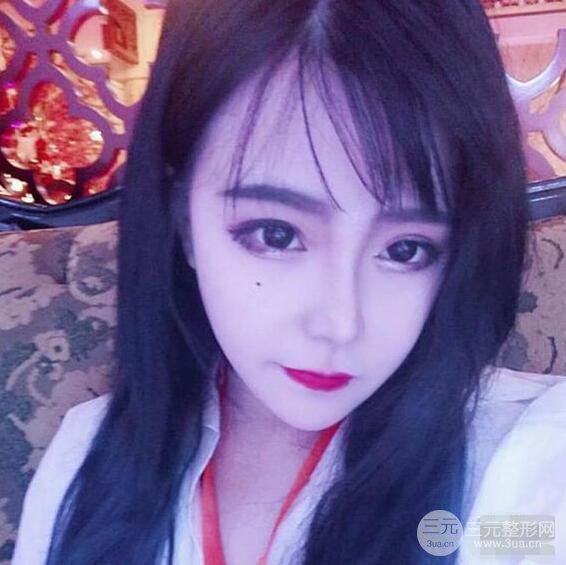 合肥壹加壹甘泉涌軟骨隆鼻前后對(duì)比圖|內(nèi)附真人案例恢復(fù)前過(guò)程