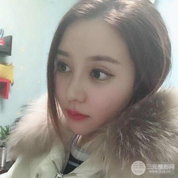 昆明吳氏嘉美李明硅膠隆鼻前后對比圖恢復心情小札