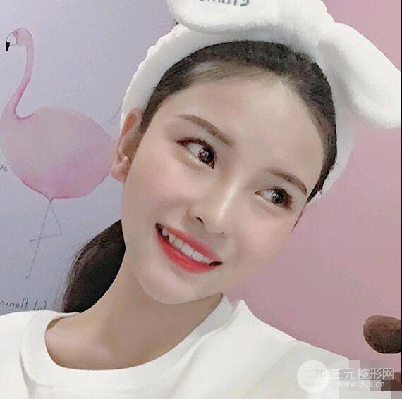 成都華西醫(yī)院整形美容科卿勇隆鼻整形前后對比圖恢復心情小札