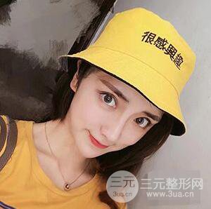 杭州格萊美張樹(shù)功假體隆鼻前后對(duì)比圖|內(nèi)附恢復(fù)心情變化哦