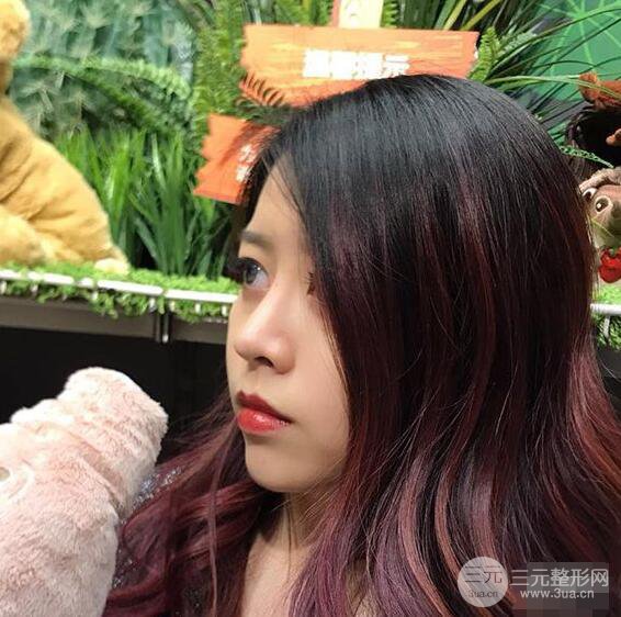 重慶華美何春濤硅膠隆鼻前后對(duì)比圖 內(nèi)附恢復(fù)心情小札