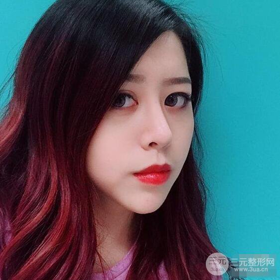 重慶華美何春濤硅膠隆鼻前后對(duì)比圖 內(nèi)附恢復(fù)心情小札