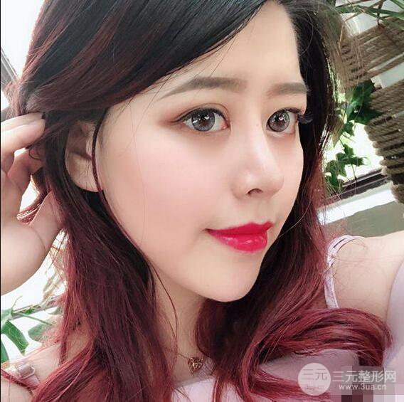 重慶華美何春濤硅膠隆鼻前后對(duì)比圖 內(nèi)附恢復(fù)心情小札