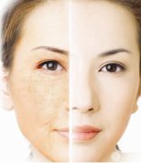 上海彩光嫩膚的價(jià)格是多少，果怎么樣？