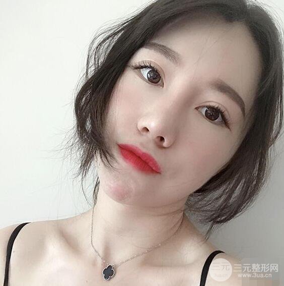 北京聯(lián)合麗格吳焱秋耳軟骨隆鼻前后對比圖|塌鼻子的救星