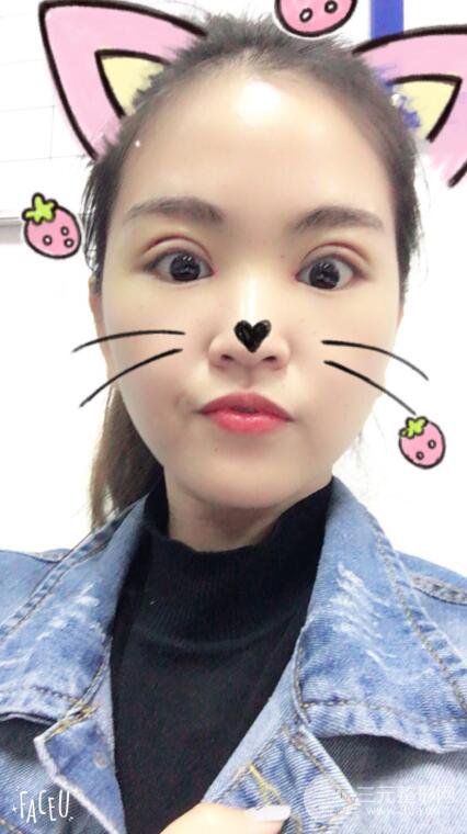 沈陽百嘉麗葉微微切開雙眼皮前后對(duì)比圖恢復(fù)心情小札