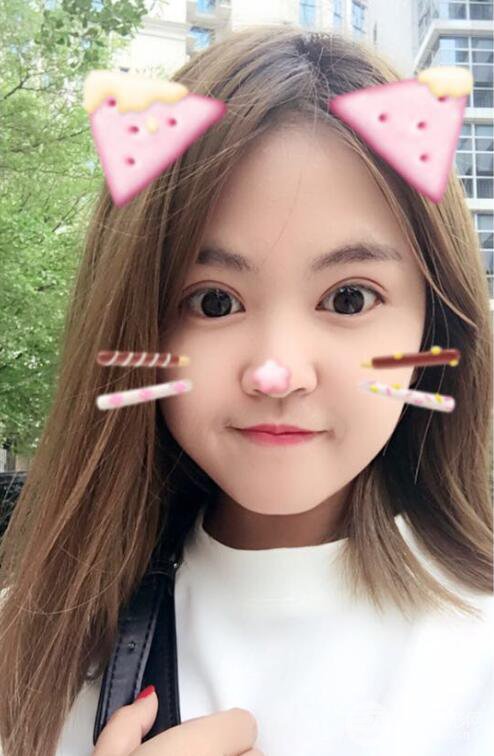 沈陽百嘉麗葉微微切開雙眼皮前后對(duì)比圖恢復(fù)心情小札