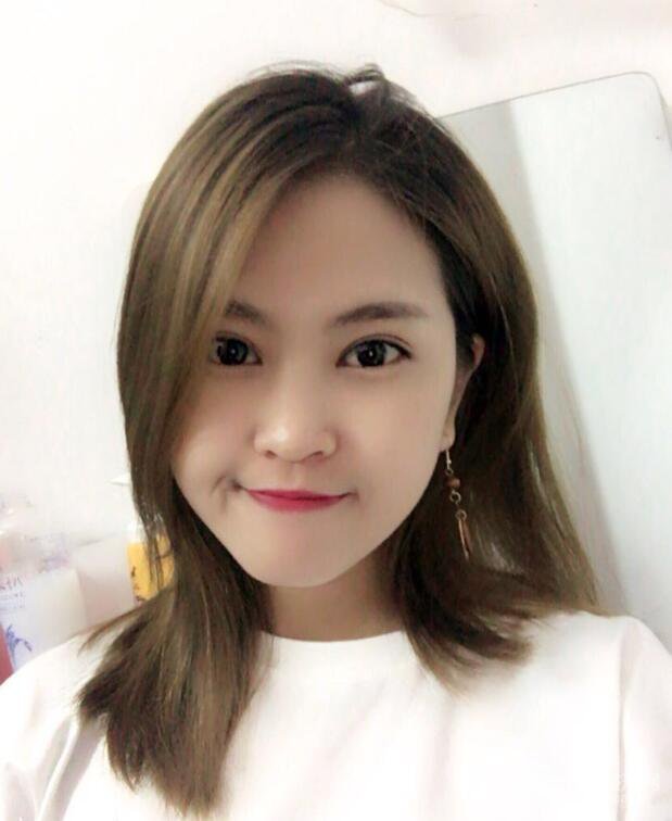 沈陽百嘉麗葉微微切開雙眼皮前后對(duì)比圖恢復(fù)心情小札