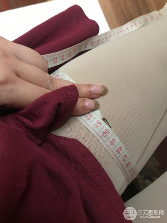 德陽東美奧克拉楊華博大腿吸脂前對對比圖 四個月恢復(fù)變化小記