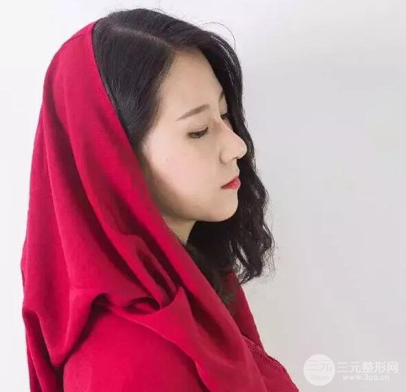 北京藝星仇侃敏微創(chuàng)肋軟骨隆鼻前后對(duì)比圖 術(shù)后一個(gè)月的恢復(fù)狀況