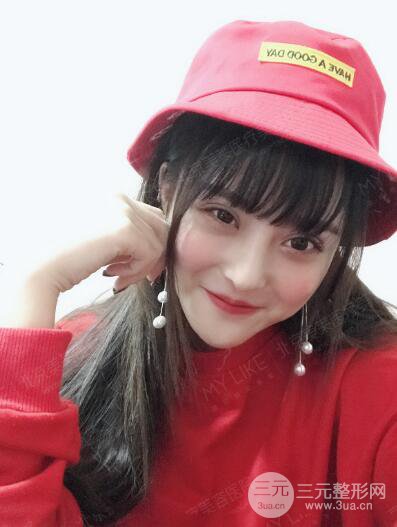 北京美萊趙峻賢隆鼻整形真實案例對比圖恢復(fù)過程分享