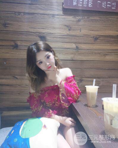 成都天使之翼張勁松切開雙眼皮案例前后對(duì)比圖心情小札