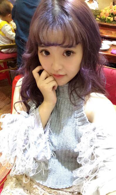 成都天使之翼張勁松切開雙眼皮案例前后對(duì)比圖心情小札