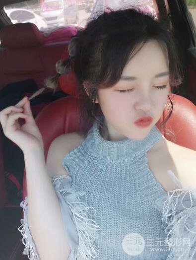 成都天使之翼張勁松切開雙眼皮案例前后對(duì)比圖心情小札