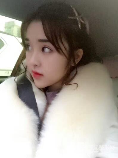 成都天使之翼張勁松切開雙眼皮案例前后對(duì)比圖心情小札