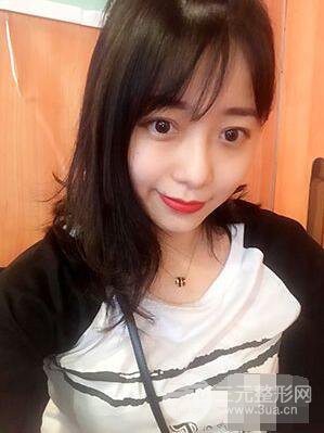 杭州華山連天美高俊明雙眼皮案例前后對(duì)比圖心情分享