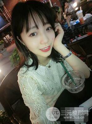 杭州華山連天美高俊明雙眼皮案例前后對(duì)比圖心情分享