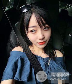 杭州華山連天美高俊明雙眼皮案例前后對(duì)比圖心情分享