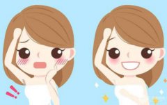 飛頓冰點脫毛多少錢呢?價格受哪些因素影響?