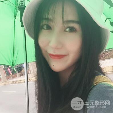 合肥壹加壹王大勇假體隆鼻果對(duì)比圖 45天恢復(fù)心路歷程