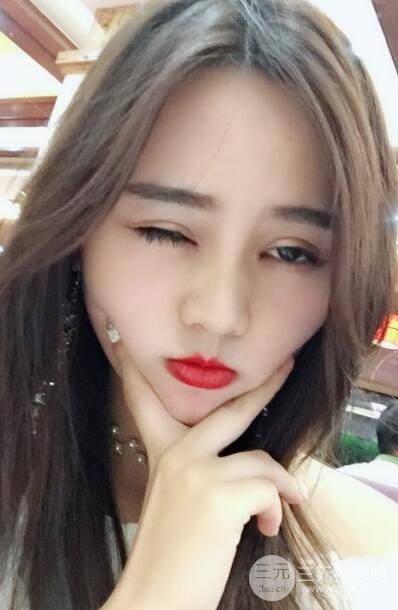 松原齊飛整形割雙眼皮真人案例前后對(duì)比圖日扎分享