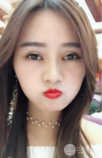 松原齊飛整形割雙眼皮真人案例前后對(duì)比圖日扎分享