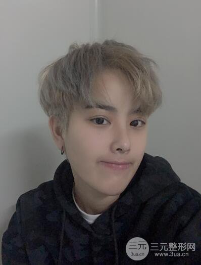 哈醫(yī)大二院整形科肖志波割雙眼皮對比圖男性案例