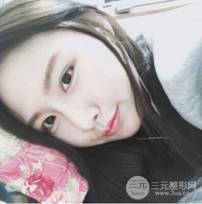 西安葉子魯禮新埋線雙眼皮案例對(duì)照?qǐng)D!兩個(gè)月恢復(fù)心情小記