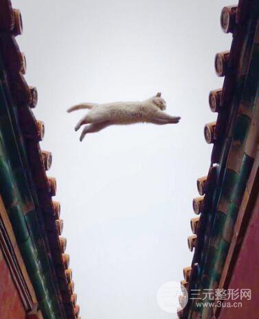 蘇州紫馨孫影塌鼻子假體隆鼻案例對比照心情小札