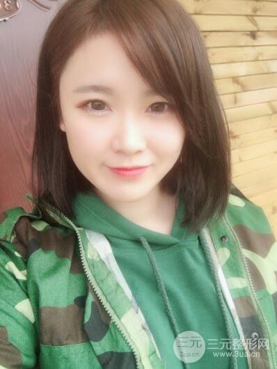 貴陽美萊梁潔芭比媚雙眼皮多項(xiàng)整形前后對比圖恢復(fù)心情小札