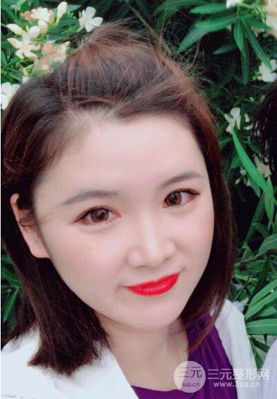 貴陽美萊梁潔芭比媚雙眼皮多項(xiàng)整形前后對比圖恢復(fù)心情小札