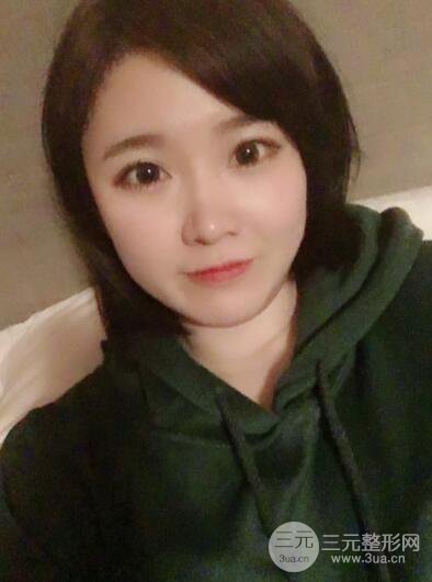 貴陽美萊梁潔芭比媚雙眼皮多項(xiàng)整形前后對比圖恢復(fù)心情小札