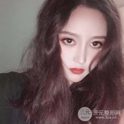 上海韓鏡魏敬想醫(yī)生的雙眼皮圖片真實案例日記分享~