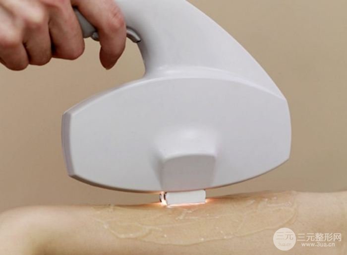 激光脫毛后可以化妝嗎?激光脫毛后要注意什么