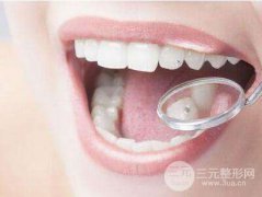 冷光牙齒美白有什么好的？冷光美白牙齒的四大優(yōu)點