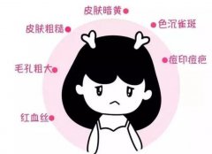 光子嫩膚護(hù)理應(yīng)該怎么做?如何做好護(hù)理工作?