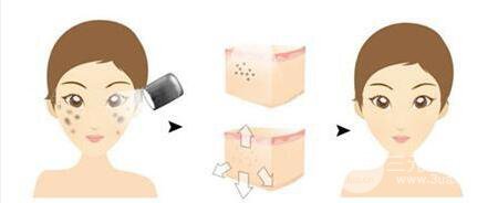 成都彩光嫩膚一般多少錢？整形改良果如何