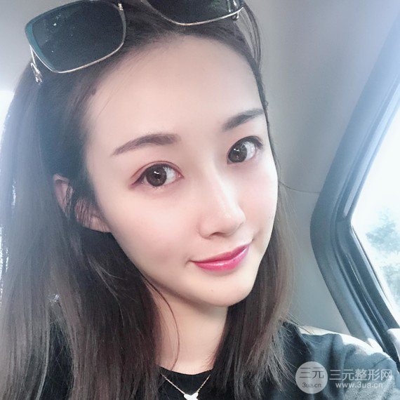 【術(shù)后3天即可上妝】大V.線 定點(diǎn)提拉 讓臉“嘭嘭嘭”！